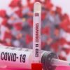 Експерт: COVID-19 в момента е по-активен от грипа