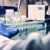 За първи път у нас: Трансплантираха стволови клетки от донор на пациент с левкемия и ХИВ