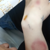 Бащата на загиналата след падане от 5 етаж Ивана: Насилвана е преди смъртта