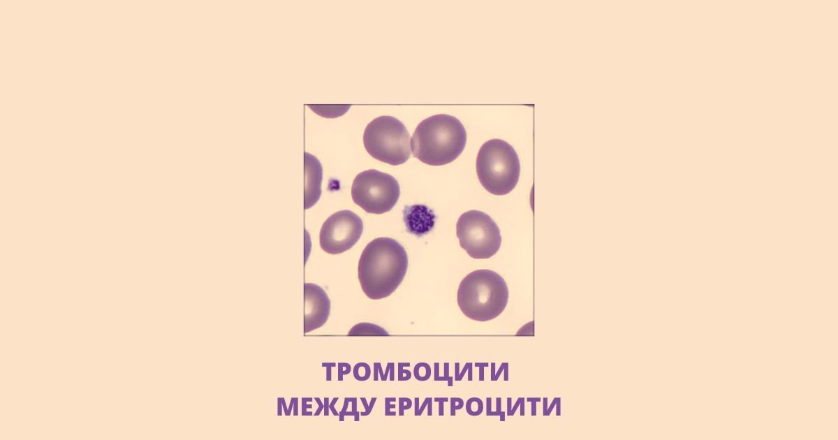 Как изглежда пълната кръвна картина? - front.bg